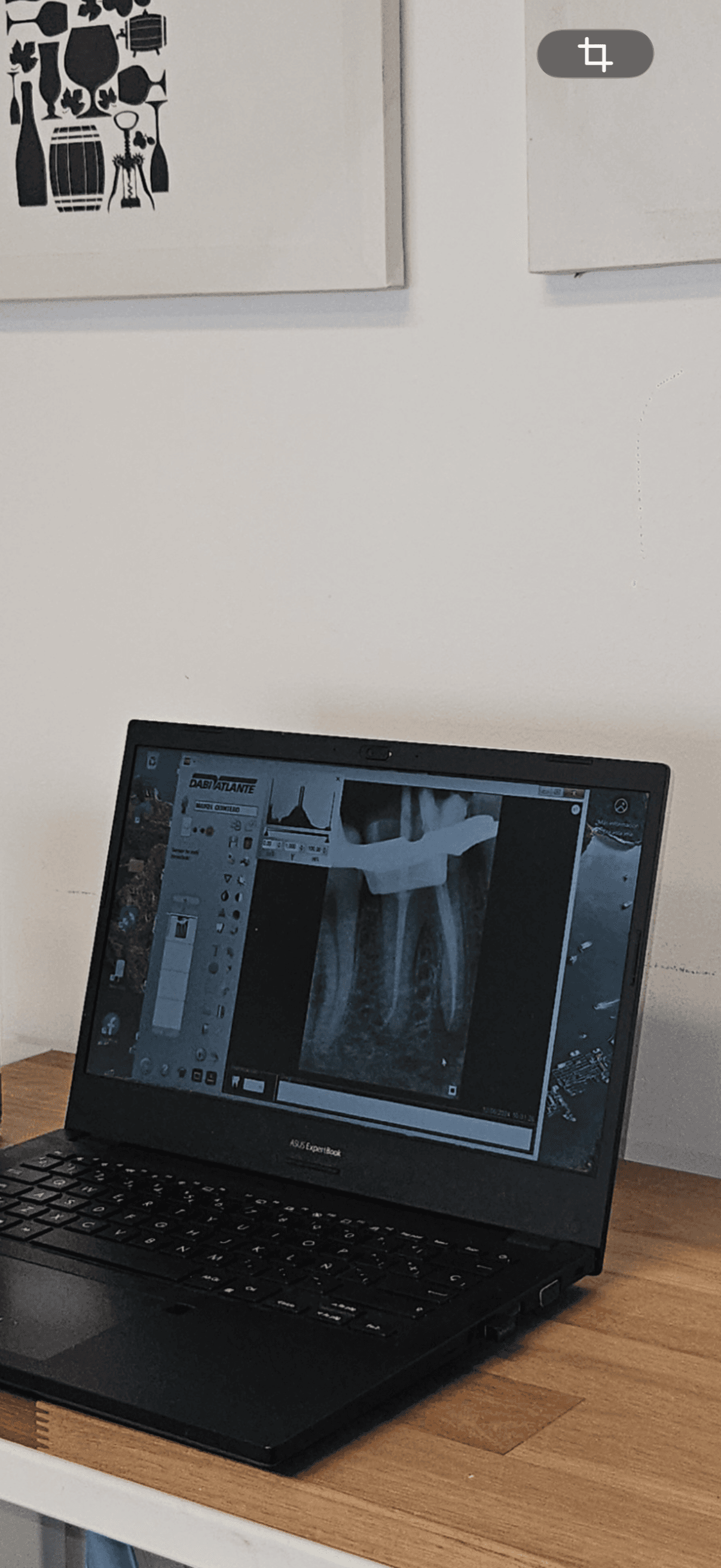 Tratamientos de conducto — atención odontológica especializada